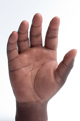 Livingskin custom handglove Livingskin custom handglove